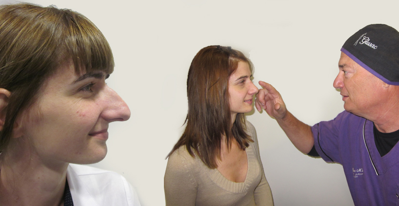 Nose operations - before after